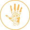 Urticaria